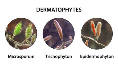 Dermatophyte mantarı, 3 boyutlu illüstrasyon. Microsporum, Trichophyton ve Epidermophyton, mantar, tinea, deri, saç ve tırnak hastalıklarının nedensel etkenleri.