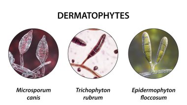 Dermatophyte mantarı, 3 boyutlu illüstrasyon. Microsporum, Trichophyton ve Epidermophyton, mantar, tinea, deri, saç ve tırnak hastalıklarının nedensel etkenleri.