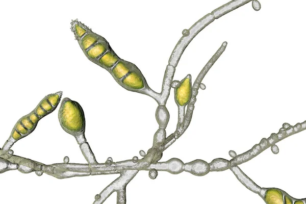 Mikroskopické Houby Microsporum Audouinii Ilustrace Antropofilní Dermatofyt Houby Způsobuje Infekce — Stock fotografie