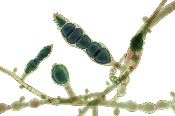 Hongos Microscópicos Microsporum Audouinii Ilustración Hongos Dermatofitos Antropofílicos Causa Infecciones —  Fotos de Stock