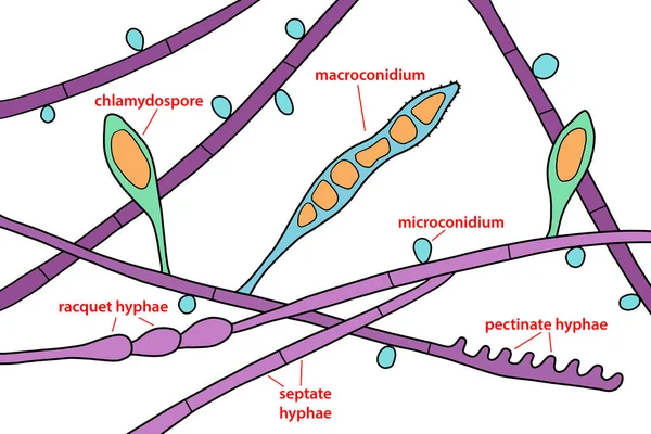 Mikroskobik Mantar Yapısı Microsporum Audouinii Illüstrasyon Antroposhilik Dermatophyt Mantar Çoğunlukla — Stok fotoğraf