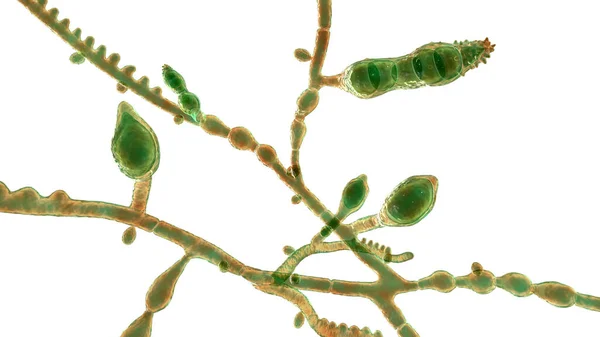 显微镜下的真菌 小孢子 3D插图 亲人性皮肤病菌 主要在儿童中引起头皮 毛细毛滴虫 体皮细毛细毛细毛细毛细毛细毛细毛细毛细毛细毛细毛细毛细毛部 — 图库照片
