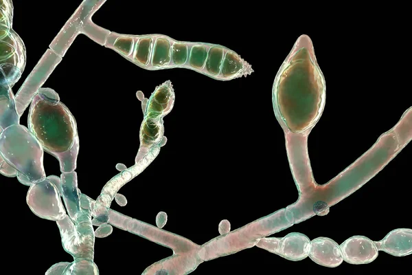 Mikroskopische Pilze Microsporum Audouinii Illustration Anthropophiler Dermatophytenpilz Verursacht Infektionen Der — Stockfoto