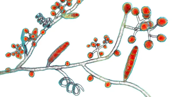 Gombák Trichophyton Mentagrophytes Illusztráció Mutatja Makroconidia Elágazó Conidiophores Viselő Gömb — Stock Fotó