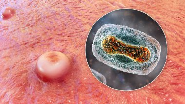 Maymun çiçeği enfeksiyonunda deri lezyonları ve maymun çiçeği virüsüne yakından bakma, üç boyutlu illüstrasyon. Poxviridae familyasından bir zoonotik virüs, çiçek benzeri bir hastalığa neden olur.