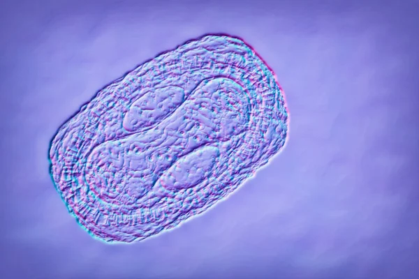 Virus Variole Singe Illustration Virus Zoonotique Famille Des Poxviridae Provoque — Photo