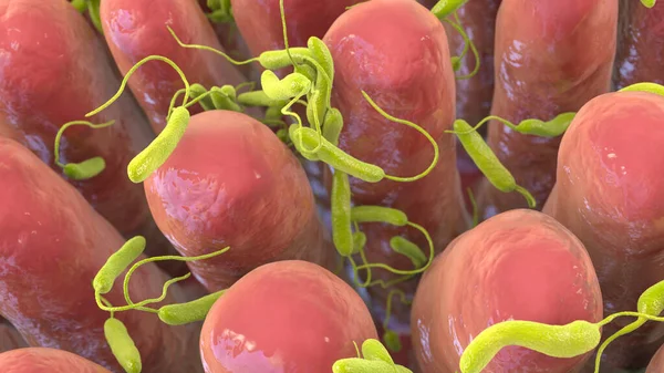Vibrio Cholerae Bakterien Infizieren Dünndarm Illustration Bakterium Das Cholera Verursacht — Stockfoto