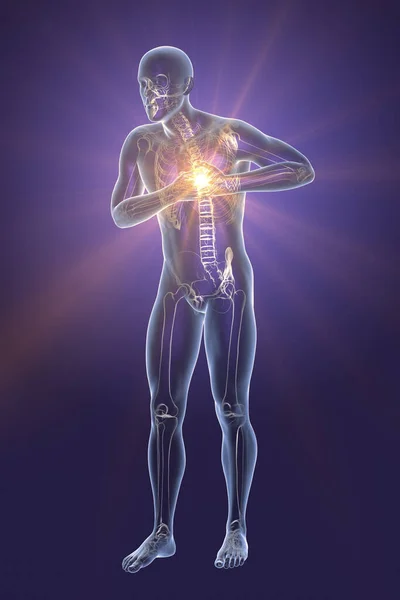 Heart attack, conceptual image for heart diseases. 3D illustration. Heart pain, myocardial infarction, a man with chest pain