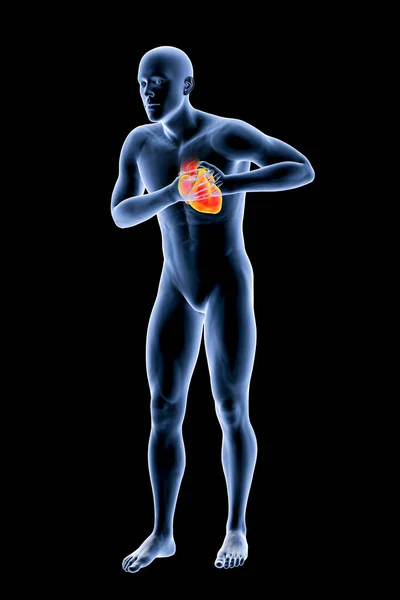 Καρδιακή Προσβολή Εννοιολογική Εικόνα Για Καρδιακές Παθήσεις Απεικόνιση Καρδιακός Πόνος — Φωτογραφία Αρχείου