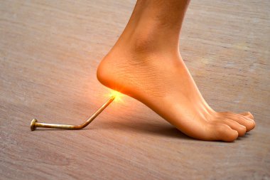 Transmission of tetanus and other anaerobic bacterial infections by contaminated wounds, 3D conceptual illustration showing old rusty metal nail as a source of foot wound infection