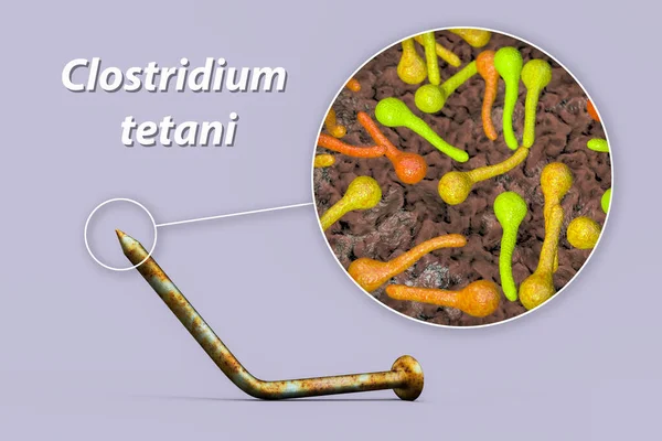 Tetanus Bacteria Clostridium Tetani Rusty Metal Nail Common Cause Transmission — Stockfoto