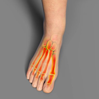 Human foot anatomy, 3D illustration. Healthy female middle age foot with partially highlighted skeleton