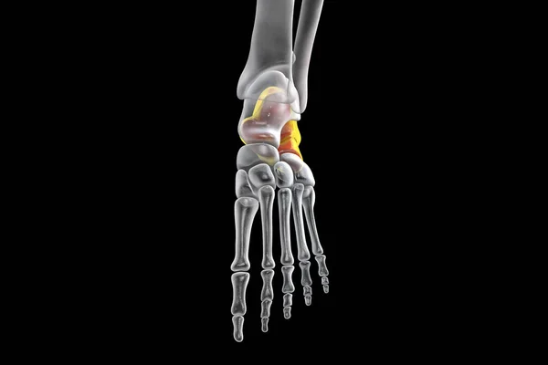 Calcaneus Bone Foot Heel Bone Largest Tarsal Bones Foot Human — 스톡 사진