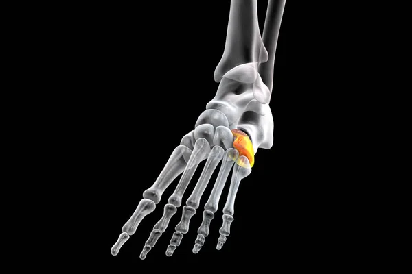Cuboid Bone Foot One Tarsal Foot Bones Human Foot Anatomy — 图库照片
