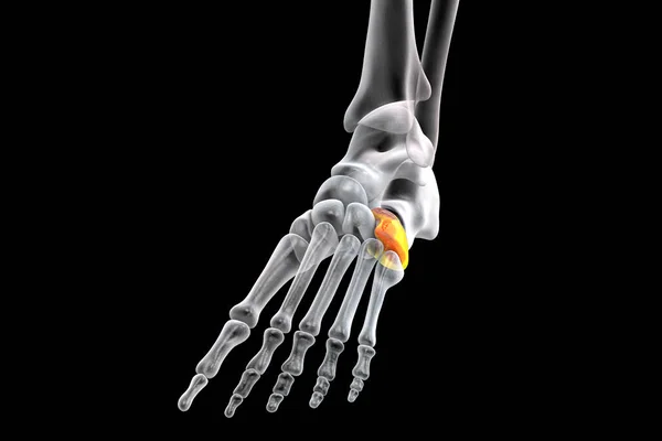 Cuboid Bone Foot One Tarsal Foot Bones Human Foot Anatomy — Φωτογραφία Αρχείου