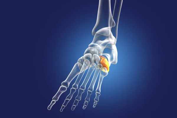 Cuboid Bone Foot One Tarsal Foot Bones Human Foot Anatomy — Stock Photo, Image