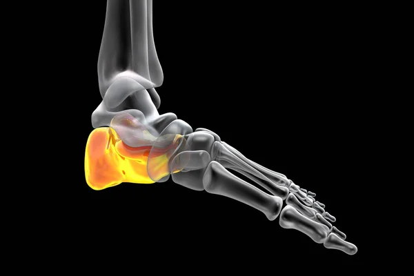 Calcaneus Bot Van Voet Hielbeen Het Grootste Tarsale Bot Voet — Stockfoto