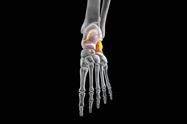 Яткова Кістка Стопи Яткова Кістка Найбільша Кісток Таля Нозі Анатомія — стокове фото