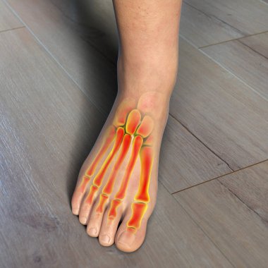 İnsan ayağı anatomisi, 3 boyutlu illüstrasyon. Kısmen çizilmiş iskeleti olan sağlıklı orta yaşlı bir kadın.