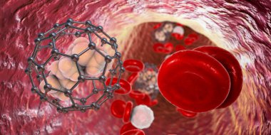 Kandaki Fullerene nanopartikülleri, kavramsal 3 boyutlu illüstrasyon. Fulleren karbon nanopartikülleri, nanomoleküler karbon kafesleri uyuşturucu ve görüntüleme araçlarını organlara ulaştırmak için kullanılır.