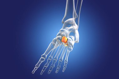 Lateral (third) cuneiform bone of the foot. Human foot anatomy. 3D illustration