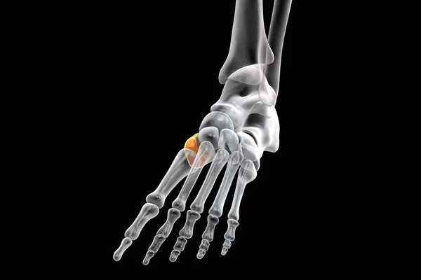 Medial First Cuneiform Bone Foot Largest Cuneiforms Human Foot Anatomy — 图库照片