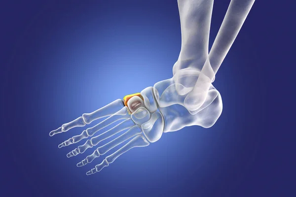 Medial (first) cuneiform bone of the foot, the largest of the cuneiforms. Human foot anatomy. 3D illustration