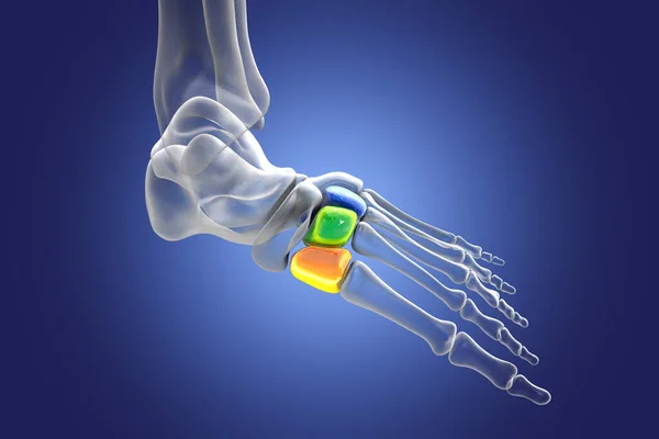 Cuneiform bones of the foot. Human foot anatomy. 3D illustration. Medial cuneiform (orange), intermediate (green), and lateral cuneiforms (blue)