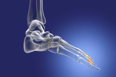 Middle phalanges of the foot. Human foot anatomy. Foot bones. 3D illustration