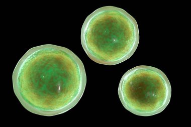 Amonyak mikroskobik patojenik mantarlar, adiaspore aşaması, 3 boyutlu illüstrasyon. Küçük hayvanlarda adiaspiromikoz akciğer hastalığının ve HIV pozitif hastalarda yayılan enfeksiyonların nedeni.