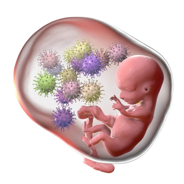 Transplacentale Overdracht Van Cytomegalovirus Cmv Andere Virussen Menselijk Embryo Conceptuele — Stockfoto