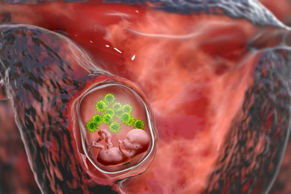 Трансплацентарная Передача Цитомегаловируса Cmv Других Вирусов Человеческому Эмбриону Концептуальная Иллюстрация — стоковое фото