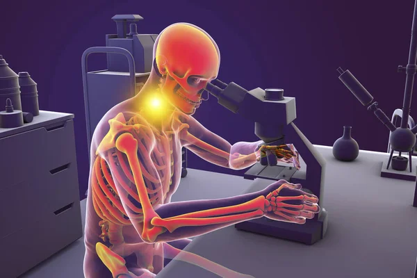 研究室作業者の作業関連の筋骨格疾患 首の痛みを持つ顕微鏡で作業強調骨格を持つ研究室の専門家を示す概念的な3Dイラスト — ストック写真