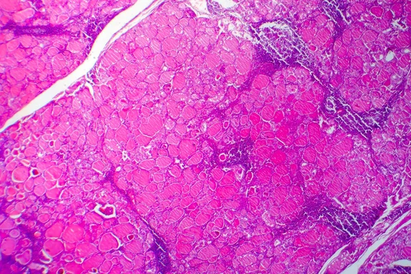 Simple Goitre Micrographie Lumineuse Photo Microscope Elargissement Glande Thyroïde Cause — Photo