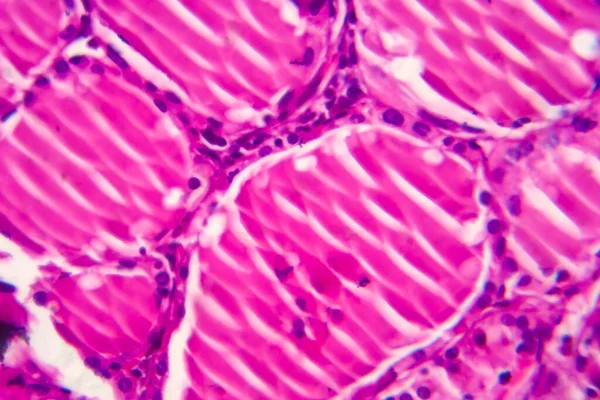 Bócio Simples Micrografia Luz Foto Sob Microscópio Alargamento Glândula Tireóide — Fotografia de Stock