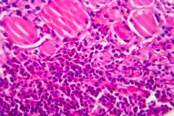 Простий Гудок Легкий Мікрограф Фотографія Під Мікроскопом Розширення Щитовидної Залози — стокове фото