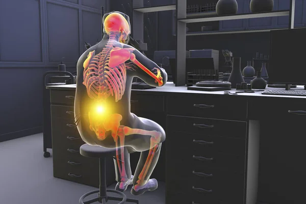 Work Related Musculoskeletal Disorders Laboratory Workers Conceptual Illustration Showing Lab — Stock Photo, Image