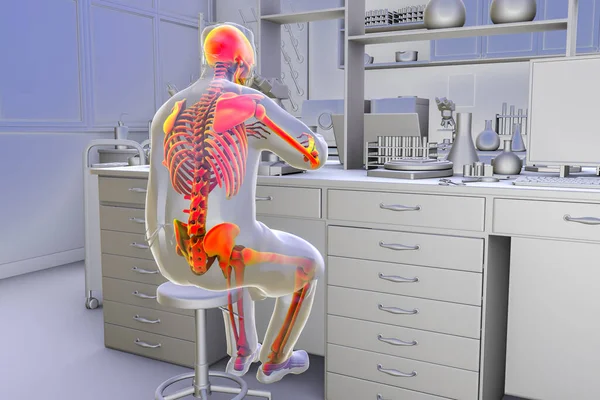 Zaburzenia Mięśniowo Szkieletowe Związane Pracą Pracowników Laboratorium Konceptualna Ilustracja Pokazująca — Zdjęcie stockowe