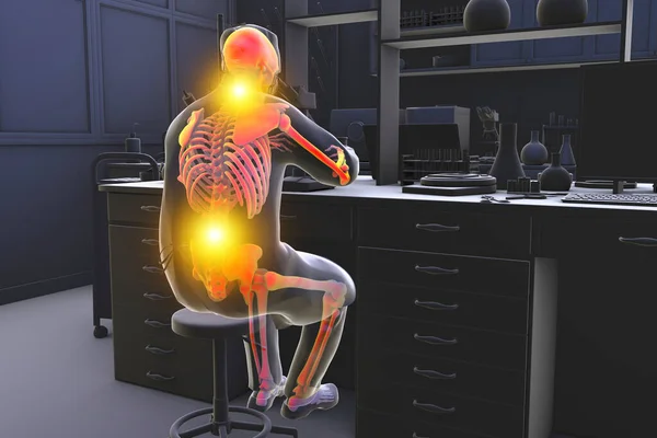 研究室の労働者の作業関連の筋骨格疾患 首と背中の痛みを持つ顕微鏡で作業強調骨格を持つ研究室の専門家を示す概念的な3Dイラスト — ストック写真
