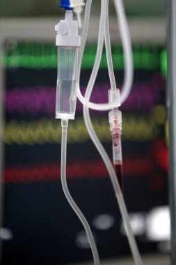 Intensive care unit. Medical equipment. Congo. 