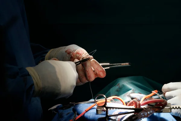 Cirugía Teatro Operaciones Hospital Fann Senegal — Foto de Stock