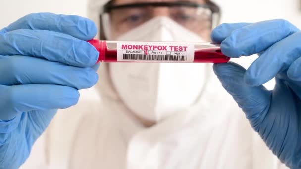 Doctor Equipped Protective Equipment Looks Blood Sample Positive Result Monkeypox — Vídeo de stock