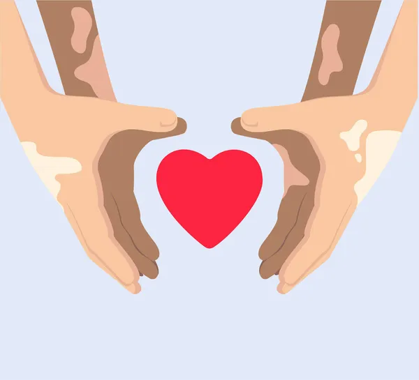 Χέρια με αποχρωματισμό λεύκη σχηματίζοντας ένα σύμβολο σχήμα καρδιάς. — Διανυσματικό Αρχείο