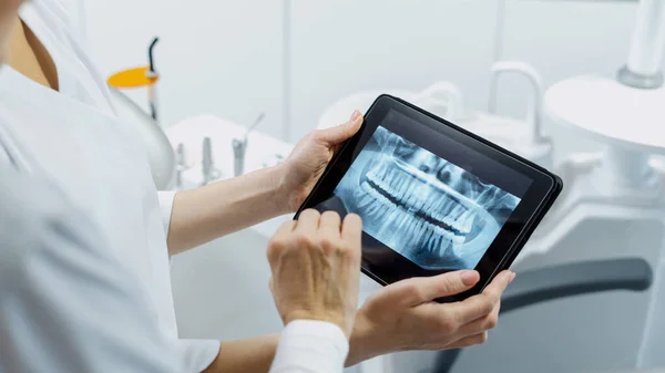 Cropped Shot Professional Dentist Showing Jaws Teeth Rays Her Patient — 图库照片