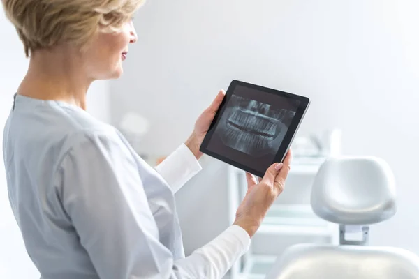 侧视图严重的专业牙医持有数字平板与她的病人的牙齿X光 看放射线照片 站在口腔科诊所 拔牙概念 — 图库照片