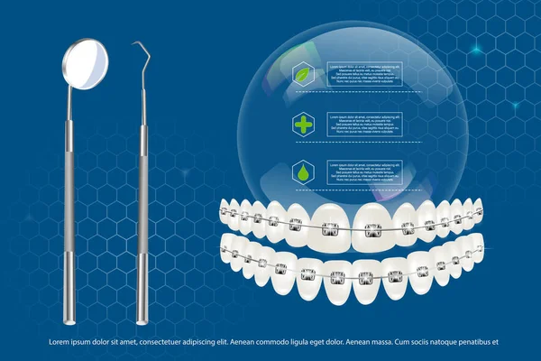 Ilustrasi vektor 3d, gigi realistis dengan kawat gigi atas dan bawah pada latar belakang infografis dan alat. Penyelarasan gigitan gigi, gigi dengan kawat gigi, kawat gigi. Stok Vektor Bebas Royalti