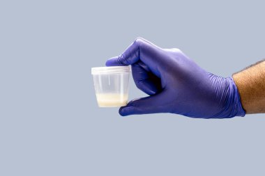 Erkek spermi ya da sperm koleksiyonu için Nitrile eldiveni, sperm bağışı konsepti
