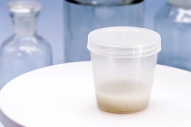 Sperm kültürü için sperm toplama kabı, patojenlerin varlığını tespit etmek için.