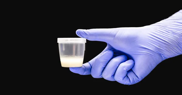 Hand Using Nitrile Glove Male Semen Sperm Collection Semen Donation — Stock Photo, Image