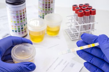 Lökosit, Urobiojen, Bilirubin, Kan, Nitrit, PH, Yoğunluk, Protein, Glikoz ve Ketoz vücutlarını analiz etmek için ayırıcı bantlarla idrar tahlili.